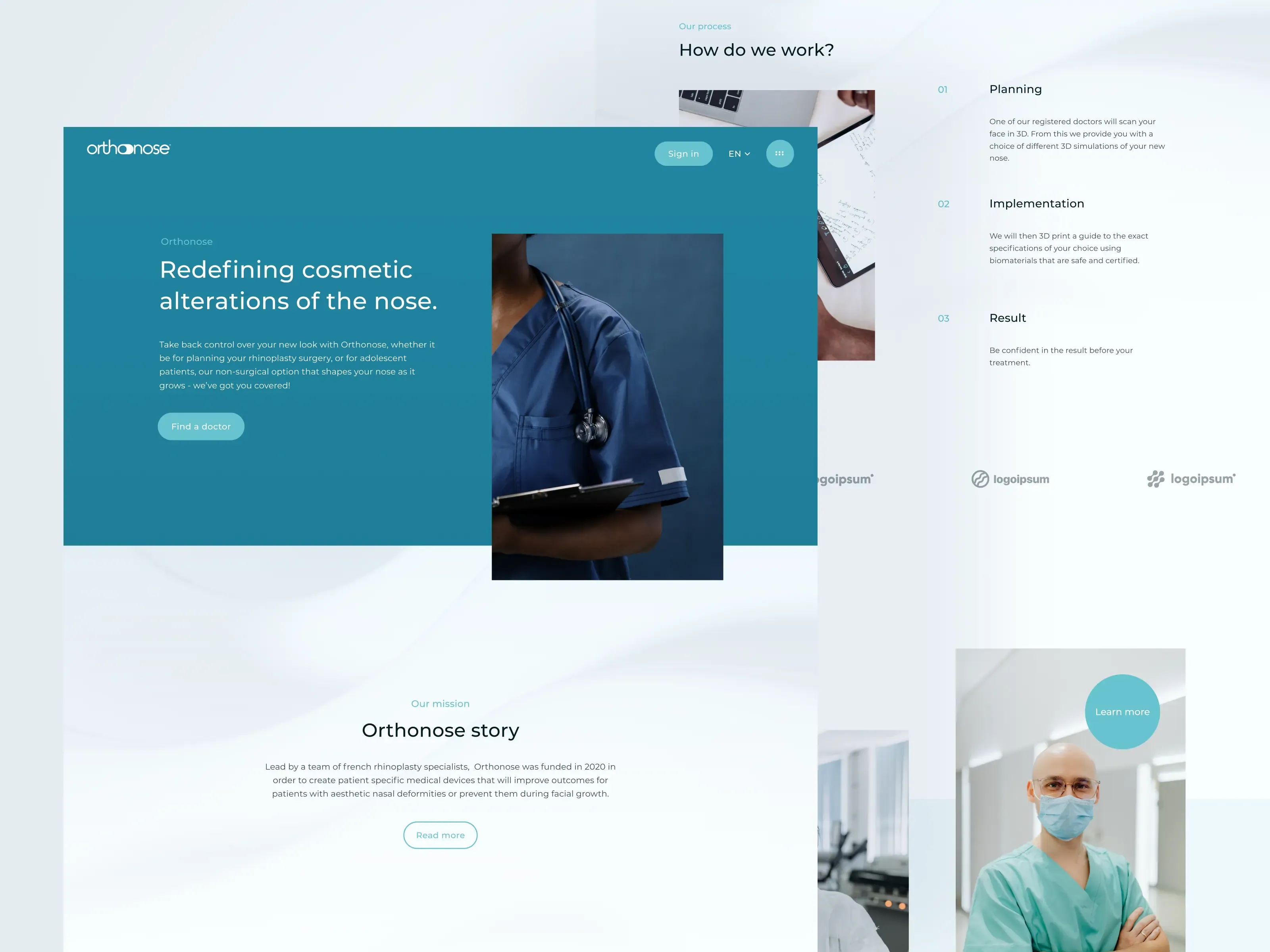 orthonose-4.webp