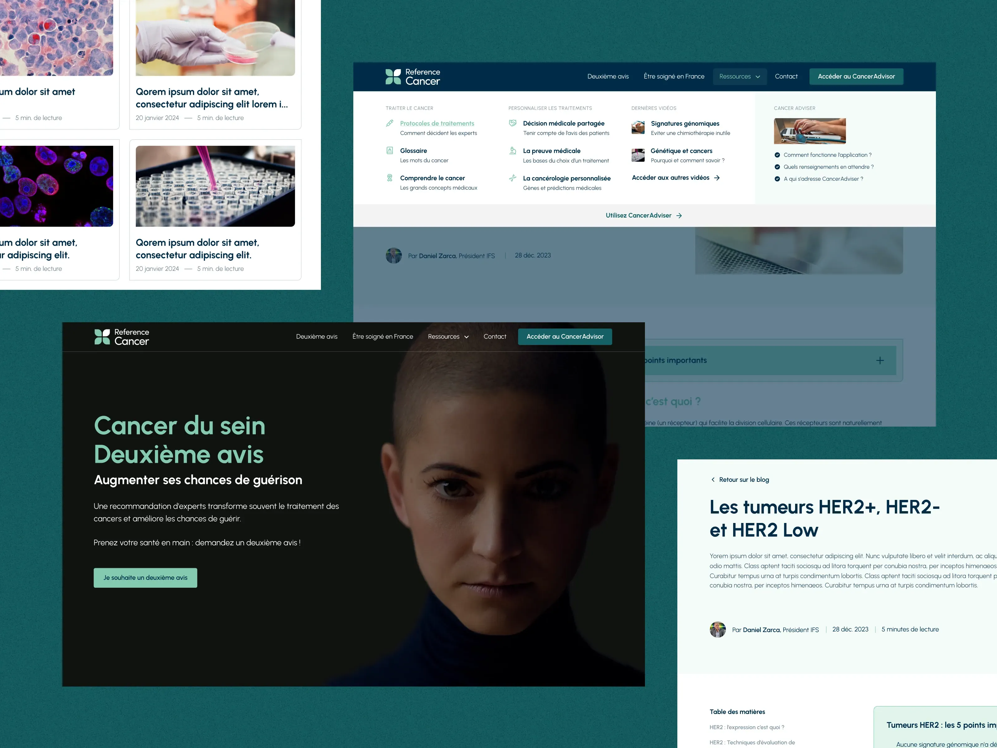 reference-cancer-3.webp